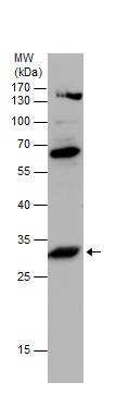 Western blot - Anti-NUBPL antibody (AB229670)