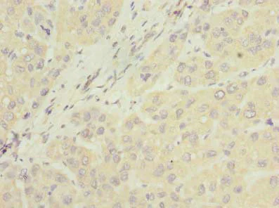 Immunohistochemistry (Formalin/PFA-fixed paraffin-embedded sections) - Anti-NUBPL antibody (AB235924)