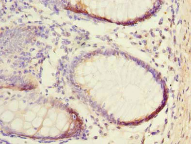Immunohistochemistry (Formalin/PFA-fixed paraffin-embedded sections) - Anti-NUBPL antibody (AB235924)