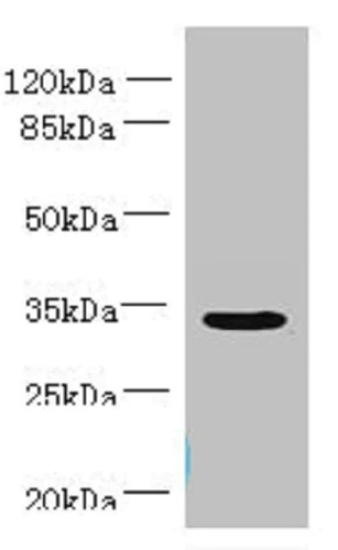 Western blot - Anti-NUBPL antibody (AB235924)