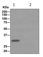 Immunoprecipitation - Anti-NUBPL antibody [EPR11833] (AB171741)