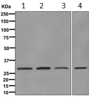Western blot - Anti-NUBPL antibody [EPR11833] - BSA and Azide free (AB249645)