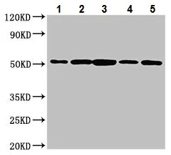Western blot - Anti-NUCB2 antibody (AB223123)