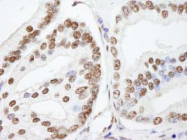 Immunohistochemistry (Formalin/PFA-fixed paraffin-embedded sections) - Anti-NUCKS1 antibody (AB84710)