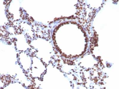 Immunohistochemistry (Formalin/PFA-fixed paraffin-embedded sections) - Anti-Nuclear Antigen antibody [NM106] - Nuclear Marker (AB215396), expandable thumbnail