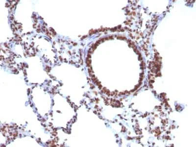 Immunohistochemistry (Formalin/PFA-fixed paraffin-embedded sections) - Anti-Nuclear Antigen antibody [NM106] - Nuclear Marker (AB215396)