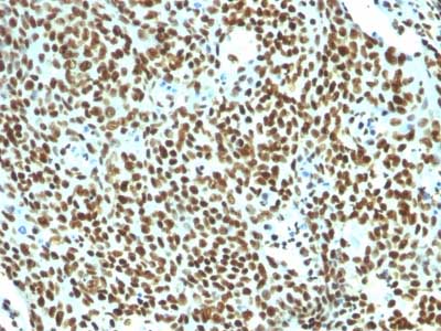Immunohistochemistry (Formalin/PFA-fixed paraffin-embedded sections) - Anti-Nuclear Antigen antibody [NM106] - Nuclear Marker (AB215396), expandable thumbnail