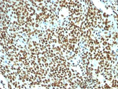 Immunohistochemistry (Formalin/PFA-fixed paraffin-embedded sections) - Anti-Nuclear Antigen antibody [NM106] - Nuclear Marker (AB215396)