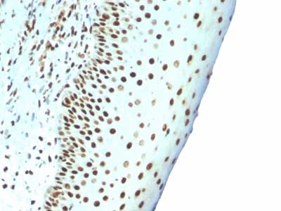 Immunohistochemistry (Formalin/PFA-fixed paraffin-embedded sections) - Anti-Nuclear Antigen antibody [NM106] - Nuclear Marker (AB215396), expandable thumbnail