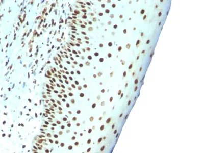 Immunohistochemistry (Formalin/PFA-fixed paraffin-embedded sections) - Anti-Nuclear Antigen antibody [NM106] - Nuclear Marker (AB215396)