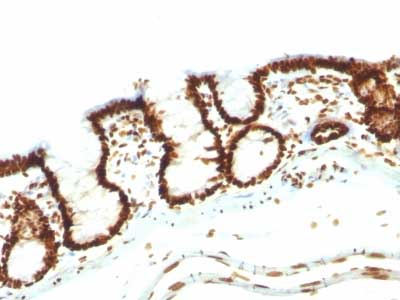 Immunohistochemistry (Formalin/PFA-fixed paraffin-embedded sections) - Anti-Nuclear Antigen antibody [NM106] - Nuclear Marker (AB215396), expandable thumbnail