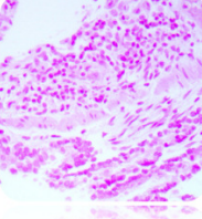 Immunohistochemistry (Formalin/PFA-fixed paraffin-embedded sections) - Nuclear Fast Red Solution (AB246831), expandable thumbnail
