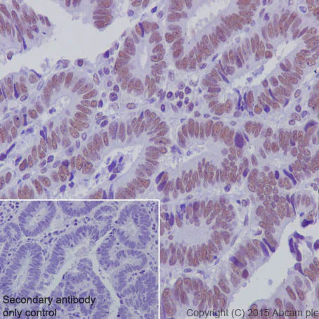 Immunohistochemistry (Formalin/PFA-fixed paraffin-embedded sections) - Nuclear Marker (Lamin A + C, SC35, KDM1/LSD1, Fibrillarin, HP1 alpha) Antibody Sampler Panel (AB263467)