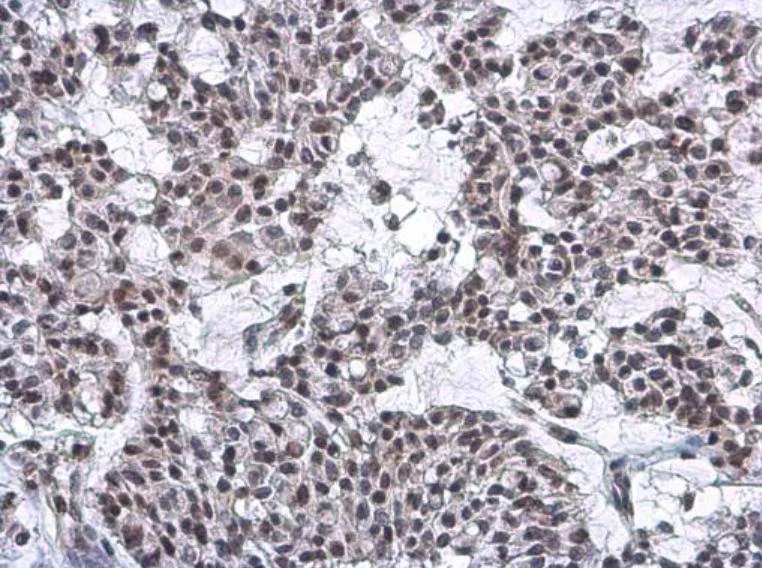 Immunohistochemistry (Formalin/PFA-fixed paraffin-embedded sections) - Anti-Nuclear Matrix Protein p84 antibody [5E10] (AB487)