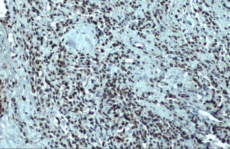 Immunohistochemistry (Formalin/PFA-fixed paraffin-embedded sections) - Anti-Nuclear Matrix Protein p84 antibody [5E10] (AB487)
