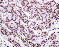Immunohistochemistry (Formalin/PFA-fixed paraffin-embedded sections) - Anti-Nuclear Matrix Protein p84 antibody [EPR5661] (AB125019), expandable thumbnail