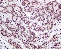 Immunohistochemistry (Formalin/PFA-fixed paraffin-embedded sections) - Anti-Nuclear Matrix Protein p84 antibody [EPR5661] (AB125019)