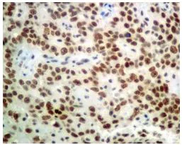 Immunohistochemistry (Formalin/PFA-fixed paraffin-embedded sections) - Anti-Nuclear Matrix Protein p84 antibody [EPR5662(2)] (AB131268)