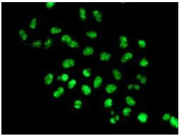Immunocytochemistry/ Immunofluorescence - Anti-Nuclear Matrix Protein p84 antibody [EPR5662(2)] - BSA and Azide free (AB232034)