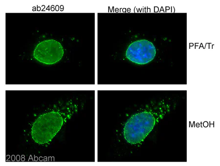 Immunocytochemistry/ Immunofluorescence - Anti-Nuclear Pore Complex Proteins antibody [Mab414] (AB24609)