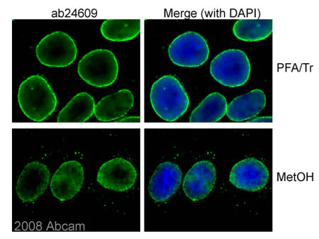 Immunocytochemistry/ Immunofluorescence - Anti-Nuclear Pore Complex Proteins antibody [Mab414] (AB24609)