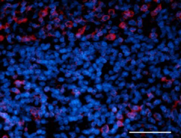 Immunohistochemistry (Formalin/PFA-fixed paraffin-embedded sections) - Anti-Nuclear Pore Complex Proteins antibody [Mab414] (ab24609), expandable thumbnail