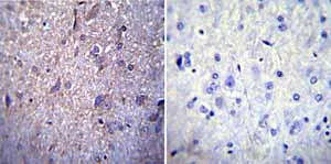 Immunohistochemistry (Formalin/PFA-fixed paraffin-embedded sections) - Anti-Nuclear Pore O-Linked Glycoprotein antibody [RL1] (AB2734)
