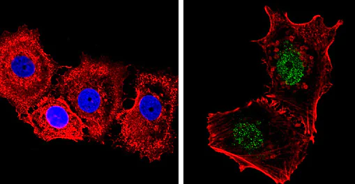 Immunocytochemistry/ Immunofluorescence - Anti-Nuclear Receptor Corepressor NCoR antibody (AB3482)