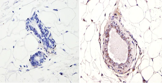 Immunohistochemistry (Formalin/PFA-fixed paraffin-embedded sections) - Anti-Nuclear Receptor Corepressor NCoR antibody (AB3482)