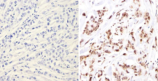 Immunohistochemistry (Formalin/PFA-fixed paraffin-embedded sections) - Anti-Nuclear Receptor Corepressor NCoR antibody (AB3482)