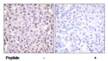 Immunohistochemistry (Formalin/PFA-fixed paraffin-embedded sections) - Anti-Nuclear Receptor Corepressor NCoR antibody (AB58396)