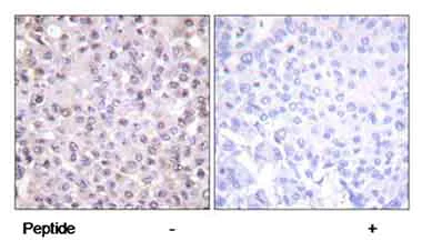 Immunohistochemistry (Formalin/PFA-fixed paraffin-embedded sections) - Anti-Nuclear Receptor Corepressor NCoR antibody (AB58396)