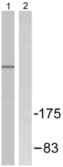 Western blot - Anti-Nuclear Receptor Corepressor NCoR antibody (AB58396)