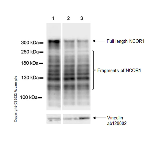 Western blot - Anti-Nuclear Receptor Corepressor NCoR antibody [EPR23834-46] (AB300615)