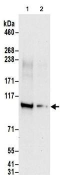 Western blot - Anti-Nucleolar protein 14 antibody (AB157112)