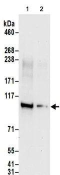Western blot - Anti-Nucleolar protein 14 antibody (AB157112)