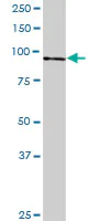Western blot - Anti-Nucleolar protein 14 antibody (AB72741)