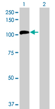 Western blot - Anti-Nucleolar protein 14 antibody (AB72741)