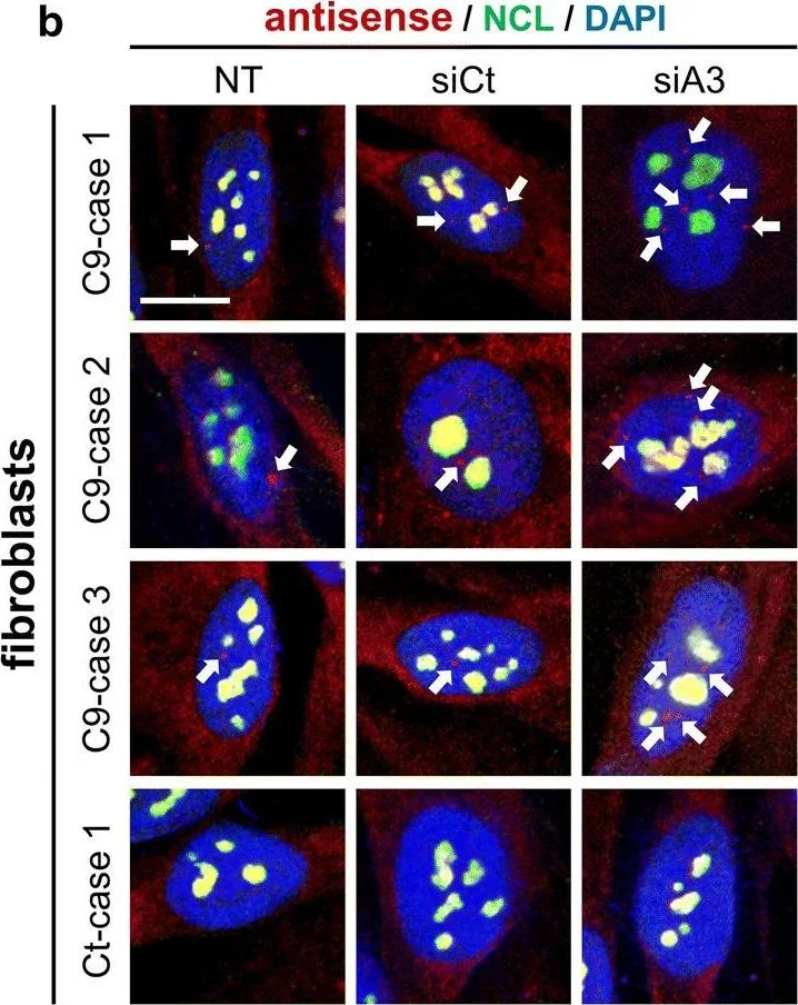 Immunocytochemistry/ Immunofluorescence - Anti-Nucleolin antibody [364-5] (AB136649)