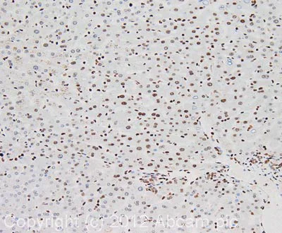Immunohistochemistry (Formalin/PFA-fixed paraffin-embedded sections) - Anti-Nucleolin antibody [364-5] (AB136649)