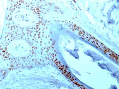 Immunohistochemistry (Formalin/PFA-fixed paraffin-embedded sections) - Anti-Nucleolin antibody [364-5] - BSA and Azide free (AB212672)