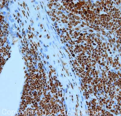 Immunohistochemistry (Formalin/PFA-fixed paraffin-embedded sections) - Anti-Nucleolin antibody (AB22758)