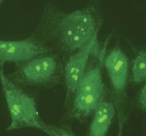 Immunocytochemistry/ Immunofluorescence - Anti-Nucleolin antibody (AB50279)
