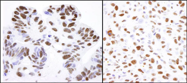 Immunohistochemistry (Formalin/PFA-fixed paraffin-embedded sections) - Anti-Nucleolin antibody (AB70493)