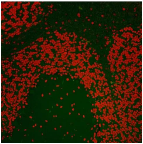 Immunohistochemistry (Formalin/PFA-fixed paraffin-embedded sections) - Anti-Nucleolin antibody (AB70493)