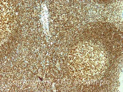 Anti-Nucleolin antibody (ab70493) | Abcam