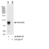 Immunoprecipitation - Anti-Nucleolin antibody (AB70493)