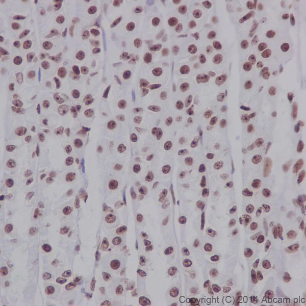 Immunohistochemistry (Formalin/PFA-fixed paraffin-embedded sections) - Anti-Nucleolin antibody [EPR7952] (AB129200)