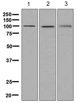 Anti-Nucleolin antibody [EPR7952]