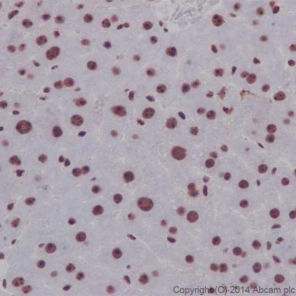 Immunohistochemistry (Formalin/PFA-fixed paraffin-embedded sections) - Anti-Nucleolin antibody [EPR7952] - BSA and Azide free (AB226113)